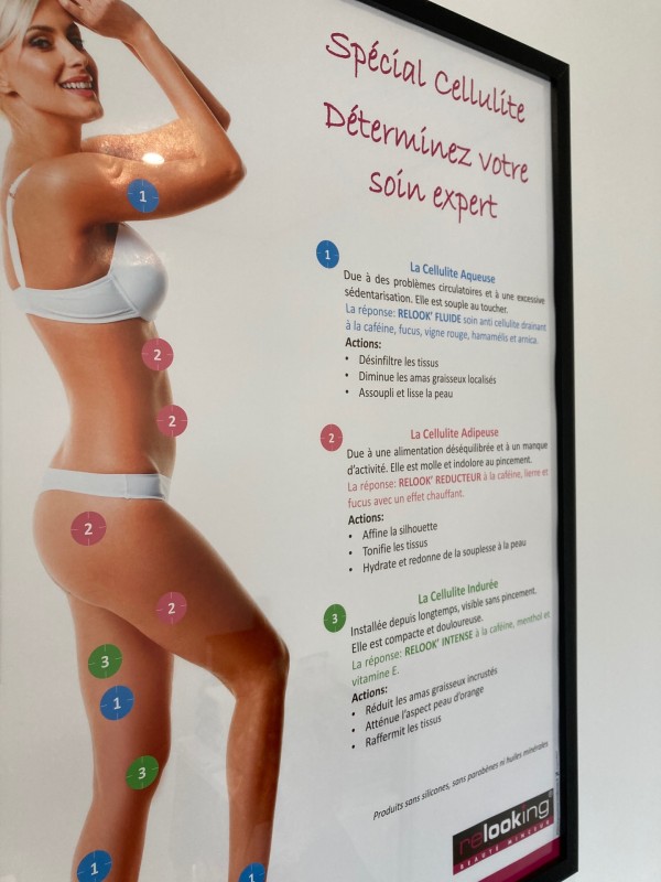 Où trouver perte de poids cellulite aux angles proche d’Avignon 84000